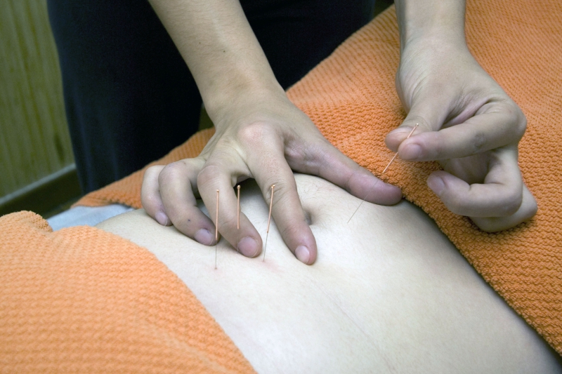 osteopathe-SEILLONS SOURCE D ARGENS-min_acupuncture-4175625